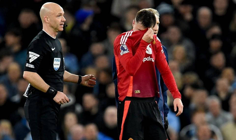 曼联球员因伤缺席,教练团队备战 曼联球员因伤缺席,教练团队备战